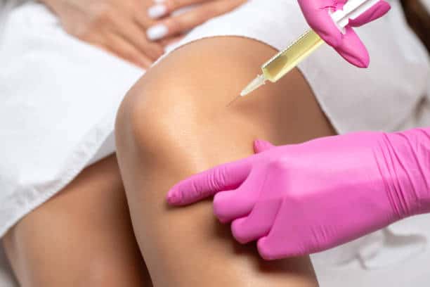 PRP therapy injection for treating runner's knee pain.