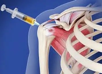 chiropractic adjustments