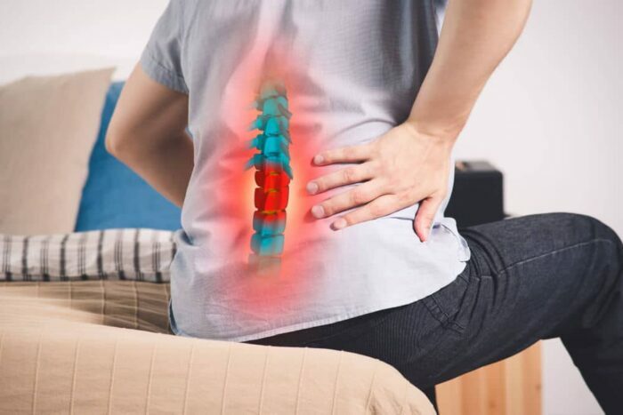 backpain due to spinal disc herniations